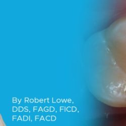 Composite posterior class tooth numbers restorations ii direct study case dentalcompare wedges proximal fender occlusal